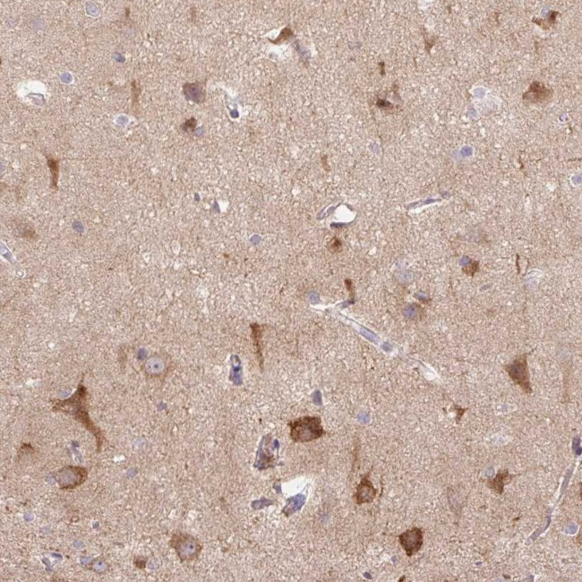 LRRTM1 Antibody in Immunohistochemistry (Paraffin) (IHC (P))