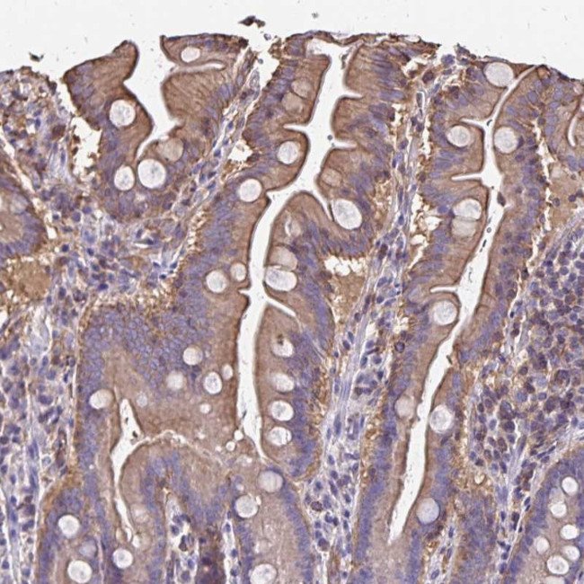 RPRML Antibody in Immunohistochemistry (Paraffin) (IHC (P))