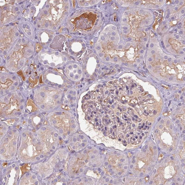 APOC4 Antibody in Immunohistochemistry (Paraffin) (IHC (P))