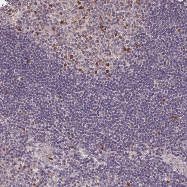 KIFC1 Antibody in Immunohistochemistry (Paraffin) (IHC (P))