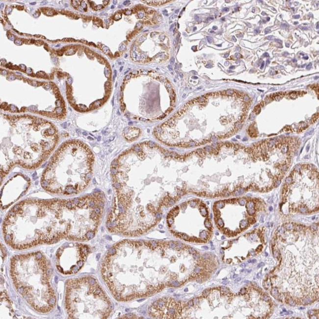 GIPC2 Antibody in Immunohistochemistry (Paraffin) (IHC (P))