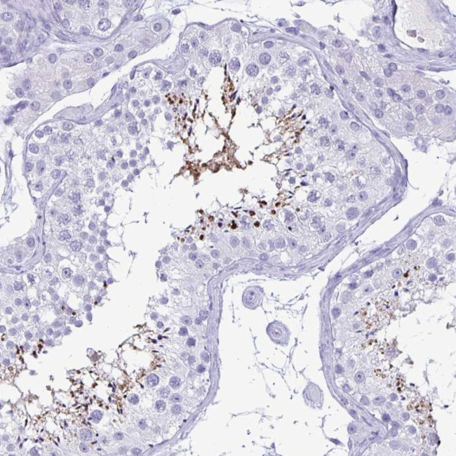 BPIFA3 Antibody in Immunohistochemistry (Paraffin) (IHC (P))