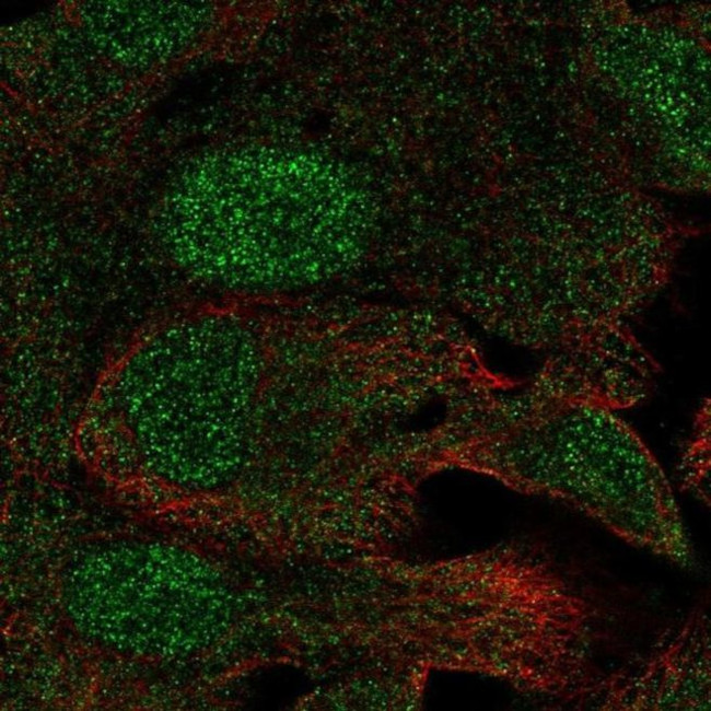 C19orf73 Antibody in Immunocytochemistry (ICC/IF)