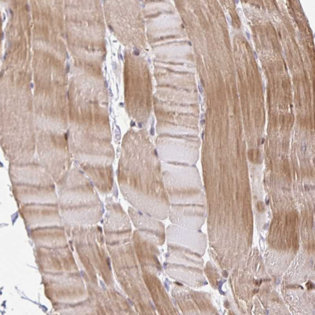 KBTBD13 Antibody in Immunohistochemistry (Paraffin) (IHC (P))