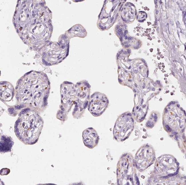 AWAT2 Antibody in Immunohistochemistry (Paraffin) (IHC (P))