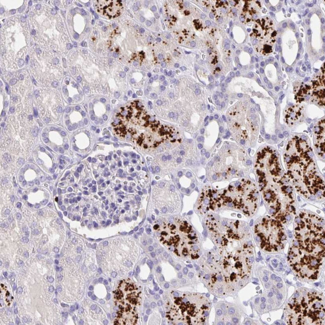 EML6 Antibody in Immunohistochemistry (Paraffin) (IHC (P))
