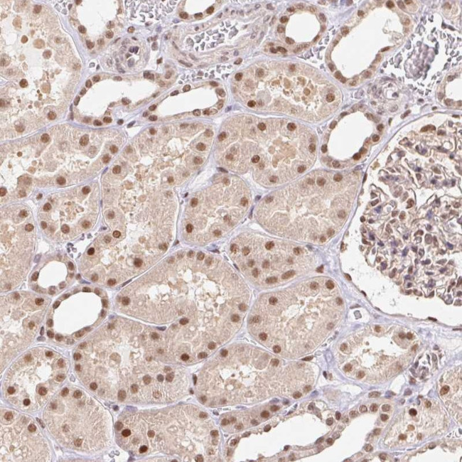 CAND1 Antibody in Immunohistochemistry (Paraffin) (IHC (P))