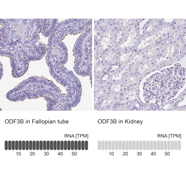 ODF3B Antibody in Immunohistochemistry (IHC)