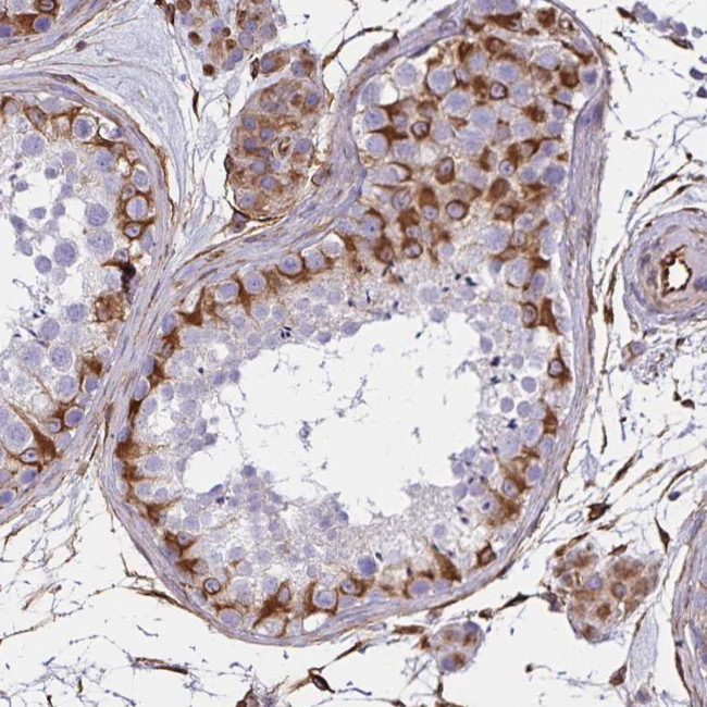 TRPV6 Antibody in Immunohistochemistry (Paraffin) (IHC (P))