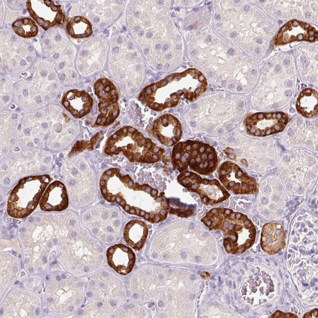 TMEM72 Antibody in Immunohistochemistry (Paraffin) (IHC (P))