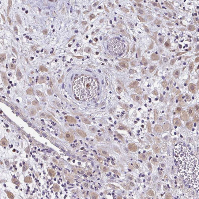 ZFP1 Antibody in Immunohistochemistry (Paraffin) (IHC (P))
