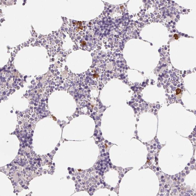 IFIT1B Antibody in Immunohistochemistry (Paraffin) (IHC (P))