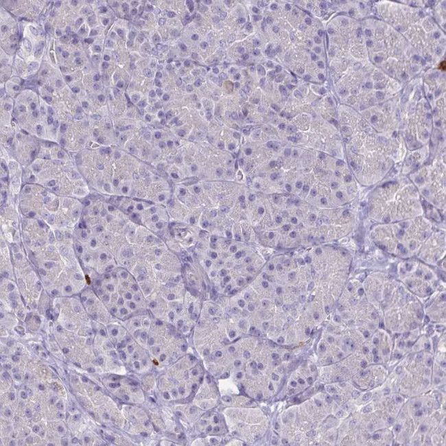 ULBP3 Antibody in Immunohistochemistry (Paraffin) (IHC (P))