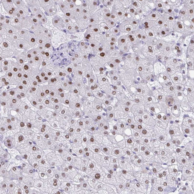 PBOV1 Antibody in Immunohistochemistry (Paraffin) (IHC (P))