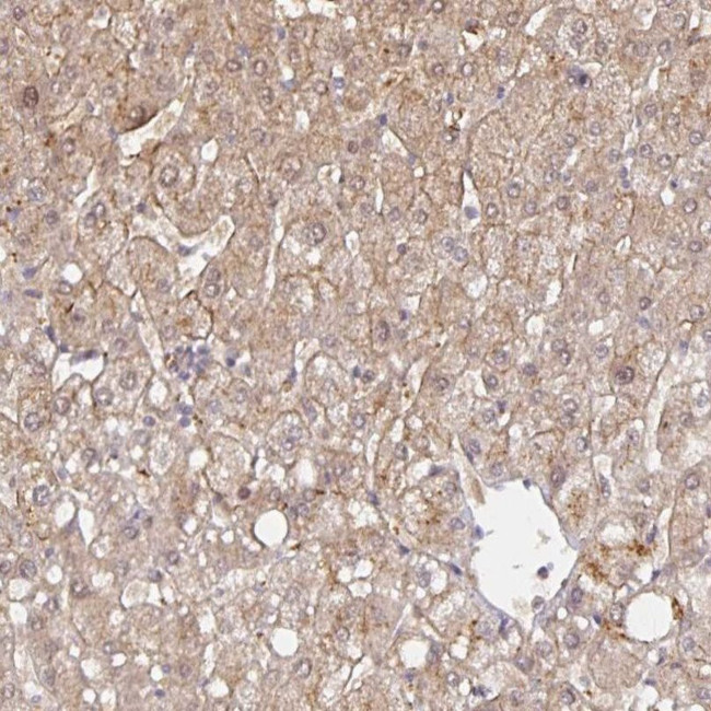 HEPN1 Antibody in Immunohistochemistry (IHC)