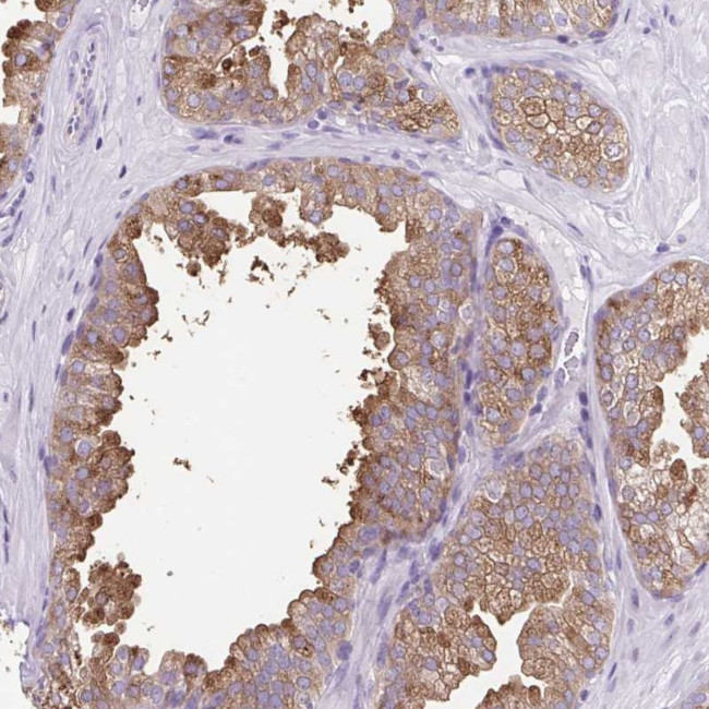 FAM177B Antibody in Immunohistochemistry (Paraffin) (IHC (P))