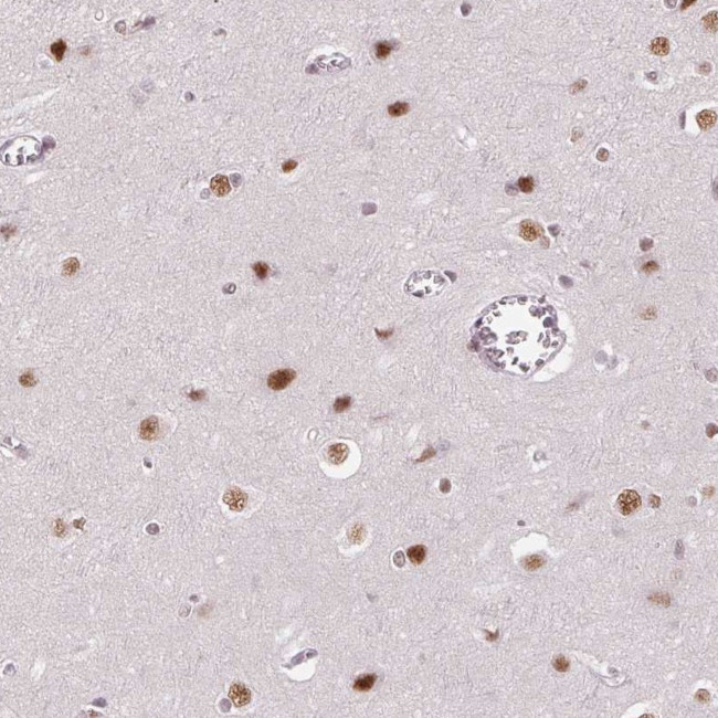 hnRNP DL Antibody in Immunohistochemistry (Paraffin) (IHC (P))