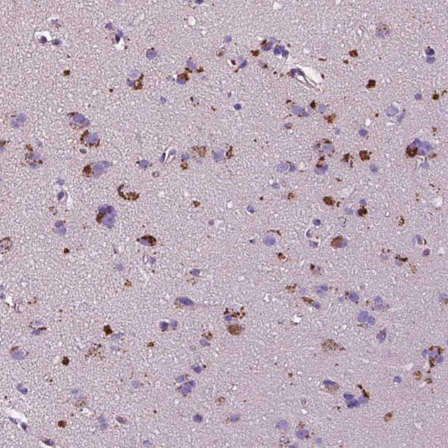 T4S20 Antibody in Immunohistochemistry (Paraffin) (IHC (P))