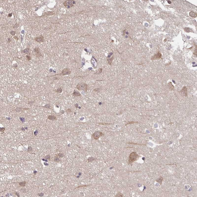 PREPL Antibody in Immunohistochemistry (Paraffin) (IHC (P))