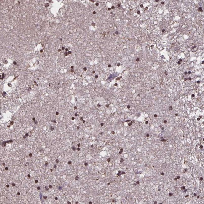 TEB4 Antibody in Immunohistochemistry (Paraffin) (IHC (P))
