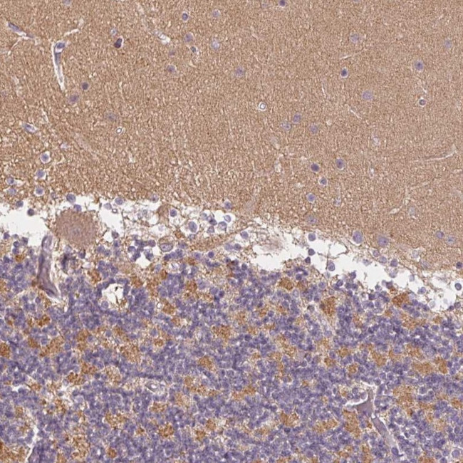 GDAP1L1 Antibody in Immunohistochemistry (Paraffin) (IHC (P))