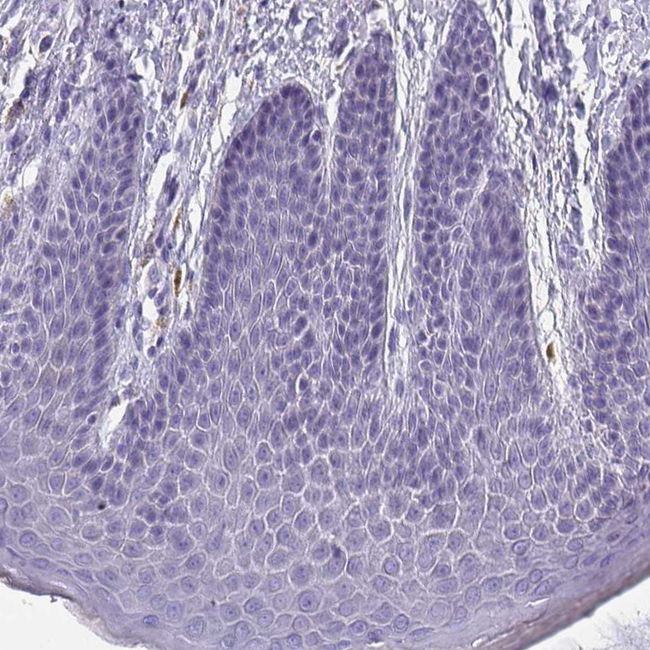ITLN1 Antibody in Immunohistochemistry (Paraffin) (IHC (P))