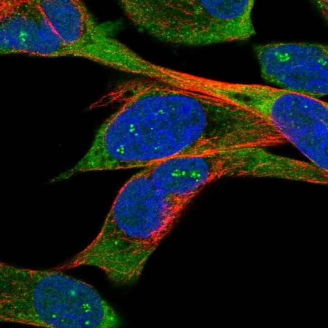 TMEM108 Antibody in Immunocytochemistry (ICC/IF)
