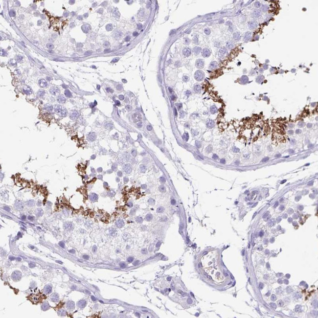 C11orf42 Antibody in Immunohistochemistry (Paraffin) (IHC (P))
