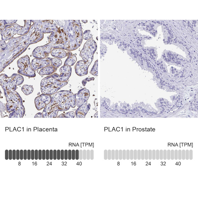PLAC1 Antibody in Immunohistochemistry (IHC)