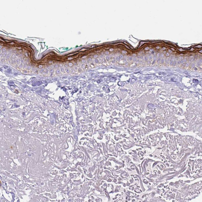 KRTDAP Antibody in Immunohistochemistry (Paraffin) (IHC (P))