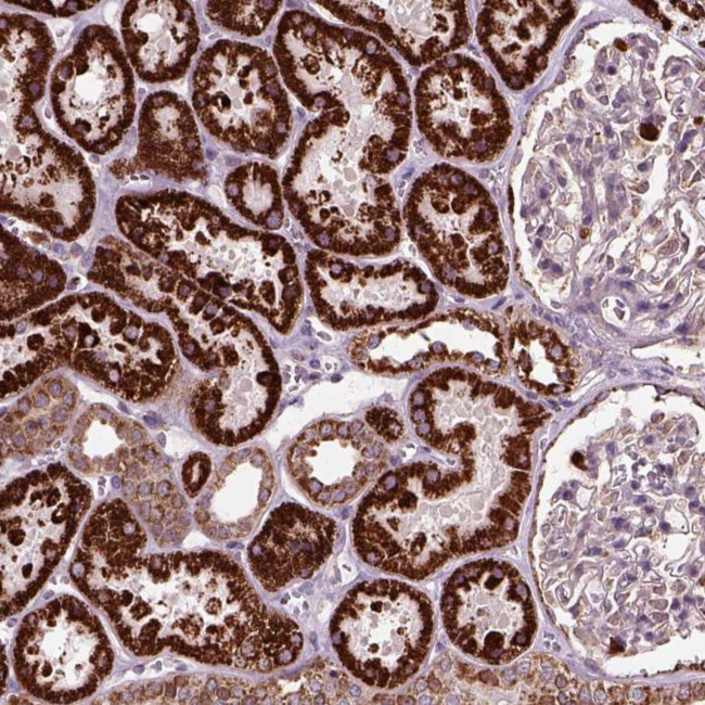 SDOS Antibody in Immunohistochemistry (Paraffin) (IHC (P))
