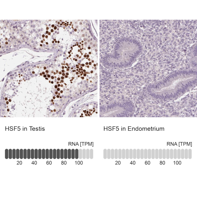 HSF5 Antibody in Immunohistochemistry (IHC)