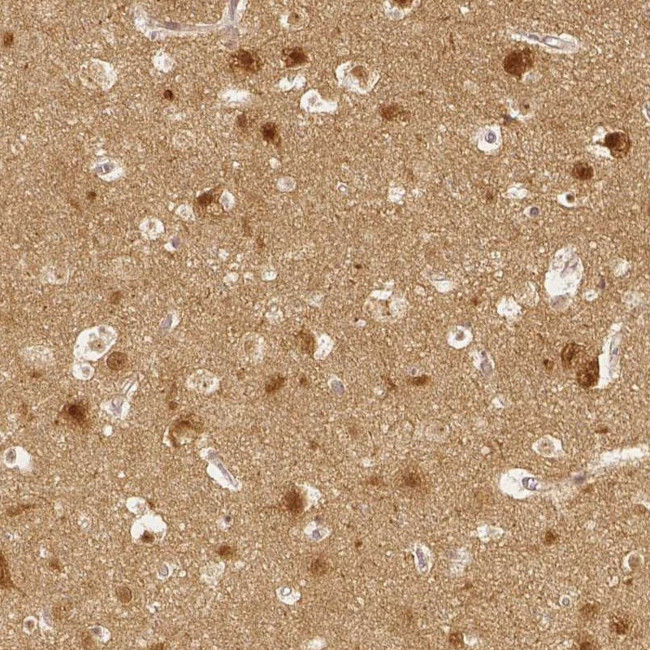SGTB Antibody in Immunohistochemistry (Paraffin) (IHC (P))