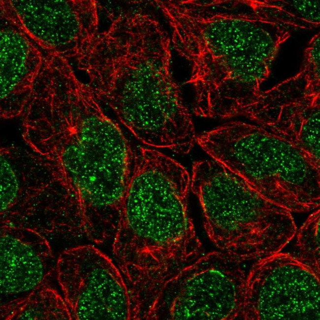 ZNF383 Antibody in Immunocytochemistry (ICC/IF)