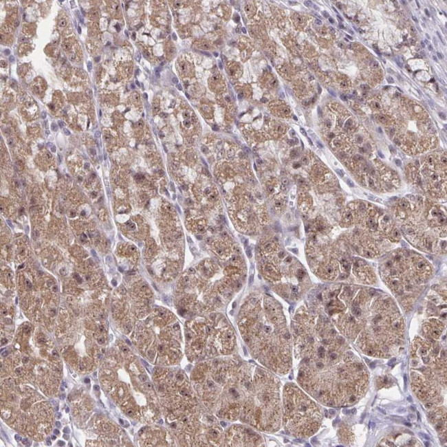 EXOC6B Antibody in Immunohistochemistry (Paraffin) (IHC (P))