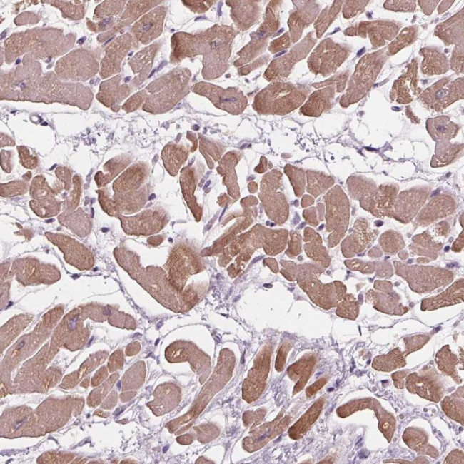 PLA2G2E Antibody in Immunohistochemistry (Paraffin) (IHC (P))