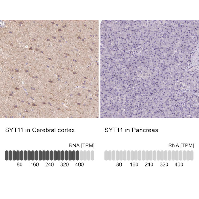 SYT11 Antibody