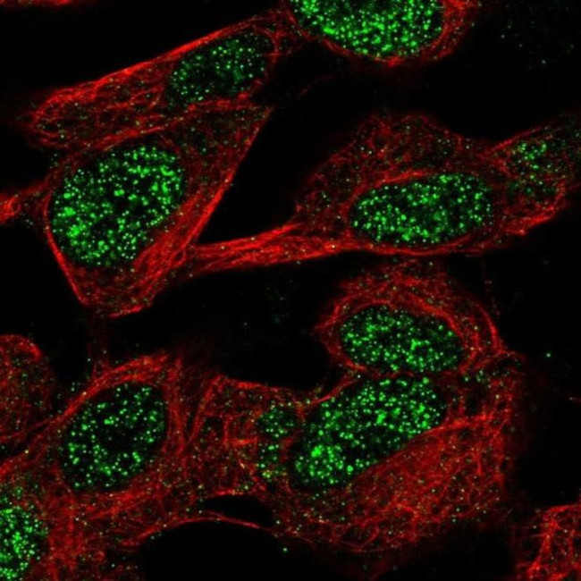 CASC10 Antibody in Immunocytochemistry (ICC/IF)