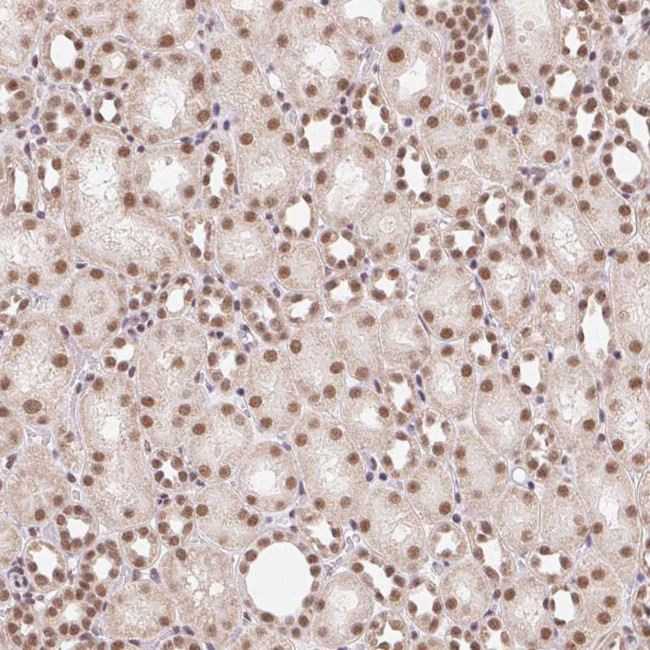 SNRPG Antibody in Immunohistochemistry (Paraffin) (IHC (P))