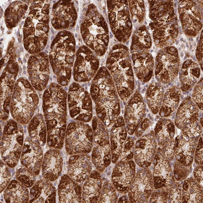 NDUFS6 Antibody in Immunohistochemistry (Paraffin) (IHC (P))