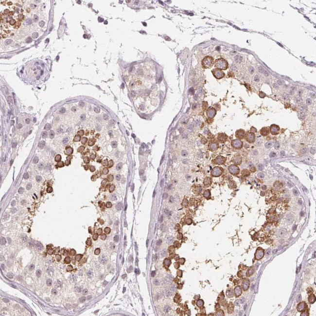 NUP210L Antibody in Immunohistochemistry (Paraffin) (IHC (P))