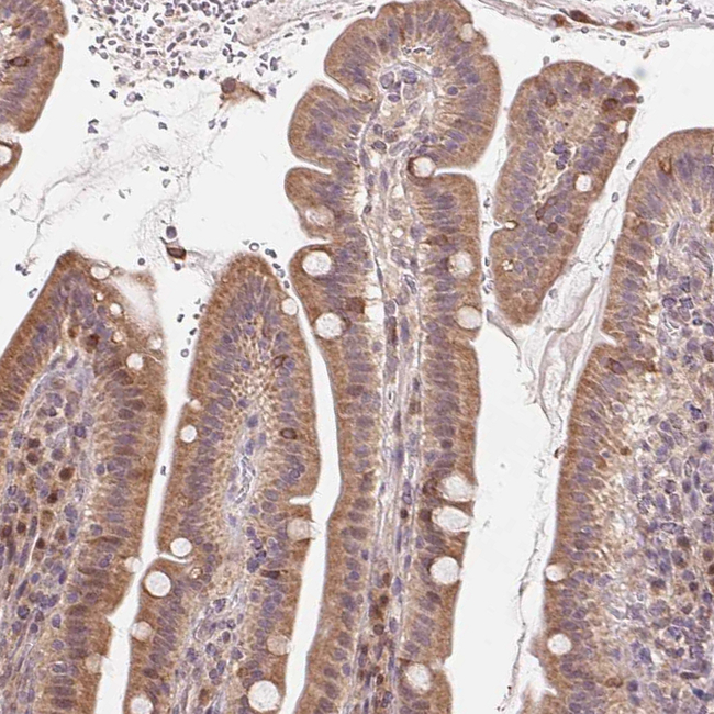CUTA Antibody in Immunohistochemistry (Paraffin) (IHC (P))