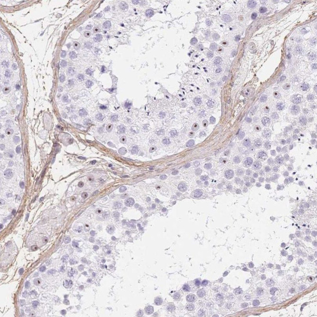 PDZD2 Antibody in Immunohistochemistry (IHC)