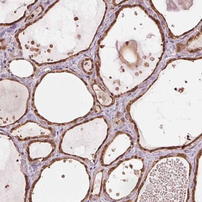 ARHGAP6 Antibody in Immunohistochemistry (IHC)