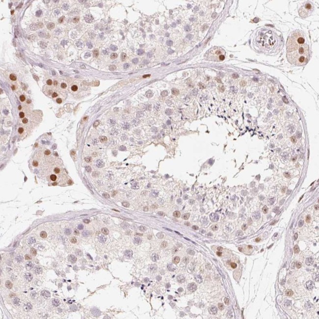 ARHGAP22 Antibody in Immunohistochemistry (Paraffin) (IHC (P))