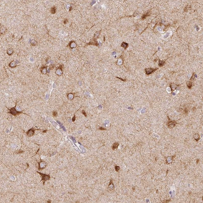 SEZ6L2 Antibody in Immunohistochemistry (Paraffin) (IHC (P))