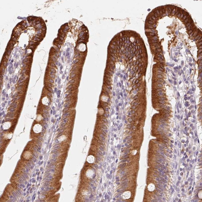 TMSB15B Antibody in Immunohistochemistry (Paraffin) (IHC (P))