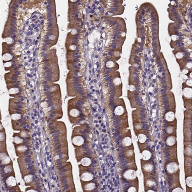 SOWAHA Antibody in Immunohistochemistry (Paraffin) (IHC (P))