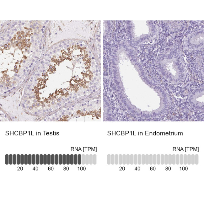SHCBP1L Antibody in Immunohistochemistry (IHC)