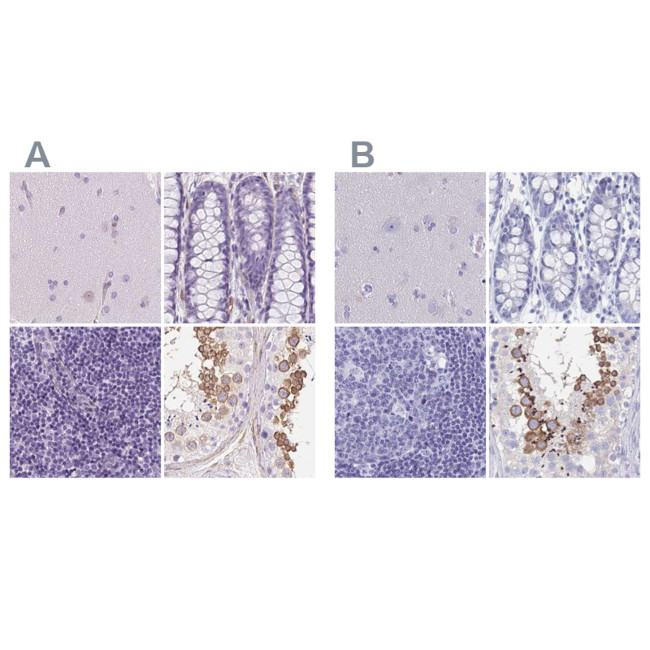 SHCBP1L Antibody in Immunohistochemistry (IHC)